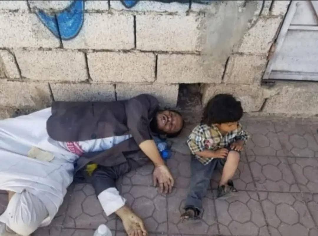 موت مواطن على أحد أرصفة الشوارع في محافظة إب كفيل بإشعال ثورة جياع